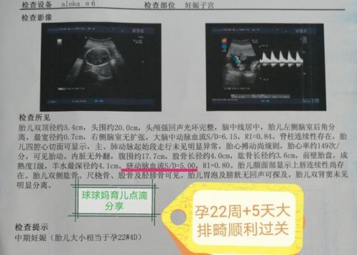 怀孕7个月四维彩超单子怎么看男女(怀孕7个月四维彩超男孩女孩图)-第2张图片-