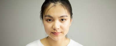 ​混合性皮肤什么特征