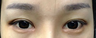 ​美眼仪怎么用