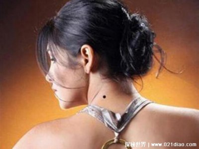 ​脖子后面有痣代表什么意思，男女有痣都说明人旺运势好