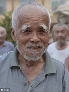 ​眉毛的生长周期 眉毛的3种变化与疾病有关