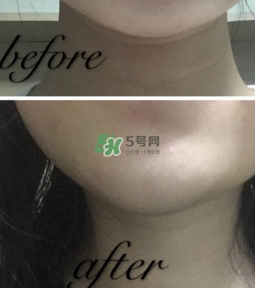 olay小白瓶有哪些版本？olay小白瓶版本区别