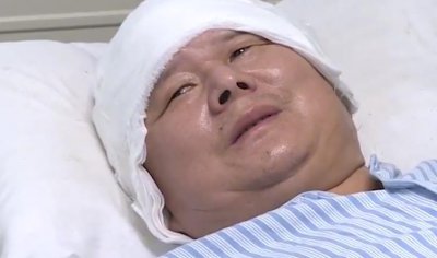 ​湖南50岁男子被称“铁皮人”，头顶铁皮散发出奇异的恶臭