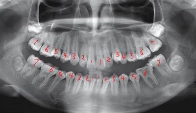 ​爱牙日的由来是什么(世界爱牙日的由来)