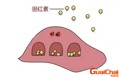 ​胆红素升高是什么原因？胆红素升高有什么危害？