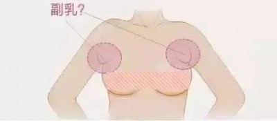 ​什么是副乳?