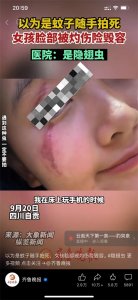 ​频频发生咬人事件的隐翅虫，到底什么来历